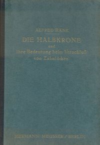 Die halbkrone und ihre Bedeutung beim Verschluss von Zahnlücken